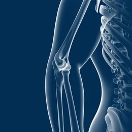 Illustration médicale radiographique d'un coude humain pour illustrer les troubles articulaires et les approches thérapeutiques en physiothérapie.