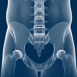 Illustration médicale en 3D du bassin et de la hanche réalisée à partir d'une radiographie afin de planifier des mesures de rééducation en physiothérapie.