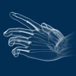Illustration anatomique radiographique d'une main humaine représentant les articulations des doigts pour la rééducation en physiothérapie.