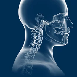 Seitliche anatomische Darstellung der Halswirbelsäule und des Schädels im Profil – Illustration zur Verdeutlichung der Ursachen von Nackenschmerzen.